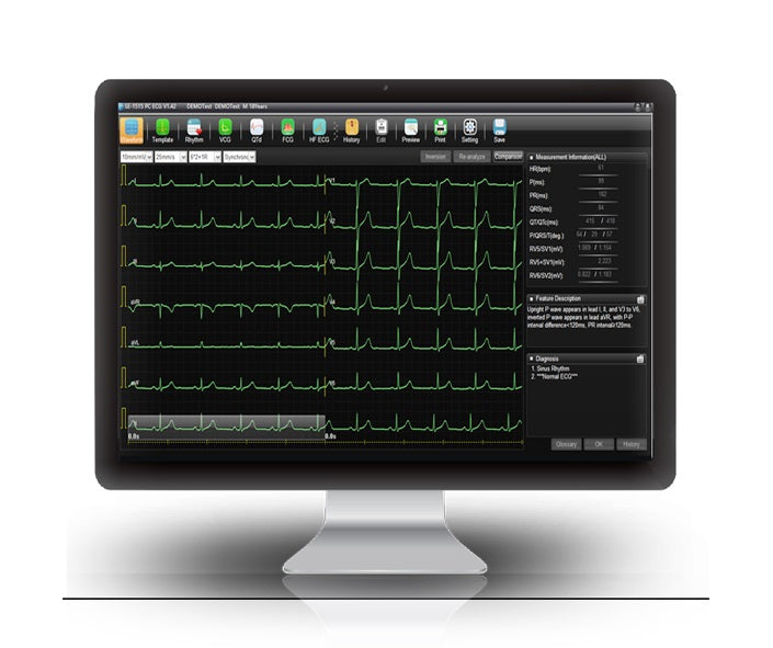Data Management System, SE-1515, Software Required for Tabletop ECG's to send data wirelessly to PC for reporting, Support Multi-Format Reports: XML/SCP/DICOM/PDF/JPG/BMP/TIF/PNG, 