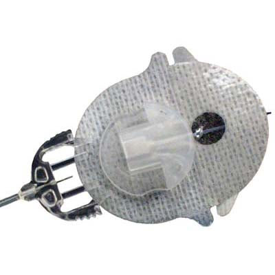 Paradigm® Silhouette® Infusion Set, 17mm, Cannula Only